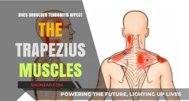 Exploring the Connection: Shoulder Tendonitis and Trapezius Muscle Impact