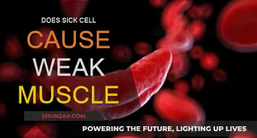 Sickle Cell Trait: Weak Muscles and Fatigue