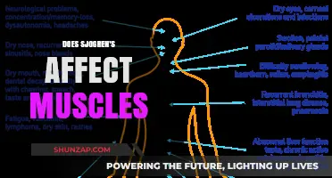 Unraveling the Mystery: Sjogren's Syndrome and Its Impact on Muscles