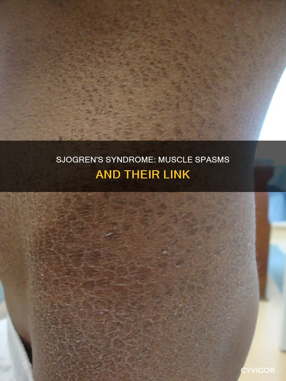 does sjogren