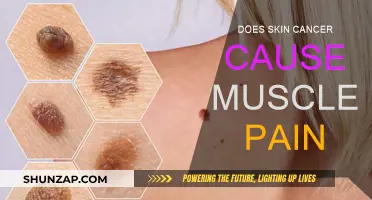 Skin Cancer and Muscle Pain: Is There a Link?