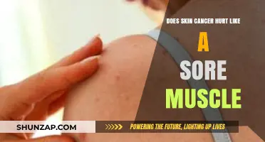 Does Skin Cancer Cause Pain Like a Sore Muscle?