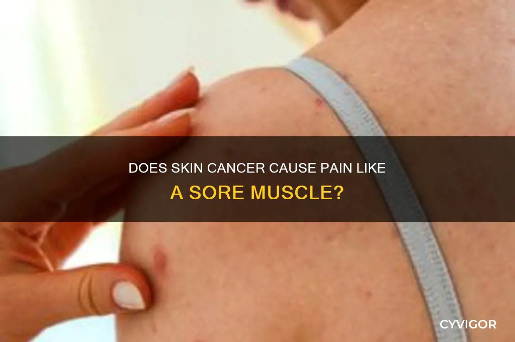 does skin cancer hurt like a sore muscle