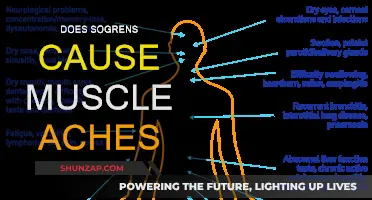 Sogren's Syndrome: Understanding Muscle Aches and Pain