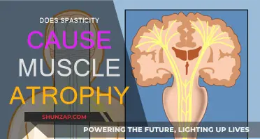 Spasticity and Muscle Atrophy: What's the Link?