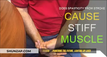 Stiff Muscles After Stroke: Understanding Spasticity