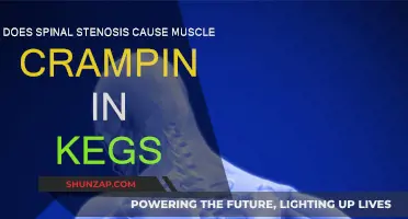 Spinal Stenosis: Leg Cramps and Muscle Spasms Explained