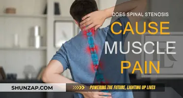 Spinal Stenosis: Understanding the Link Between Condition and Muscle Pain