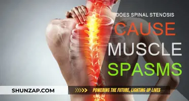 Spinal Stenosis: Understanding the Link with Muscle Spasms