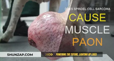 Spindle Cell Sarcoma: Understanding the Link to Muscle Pain