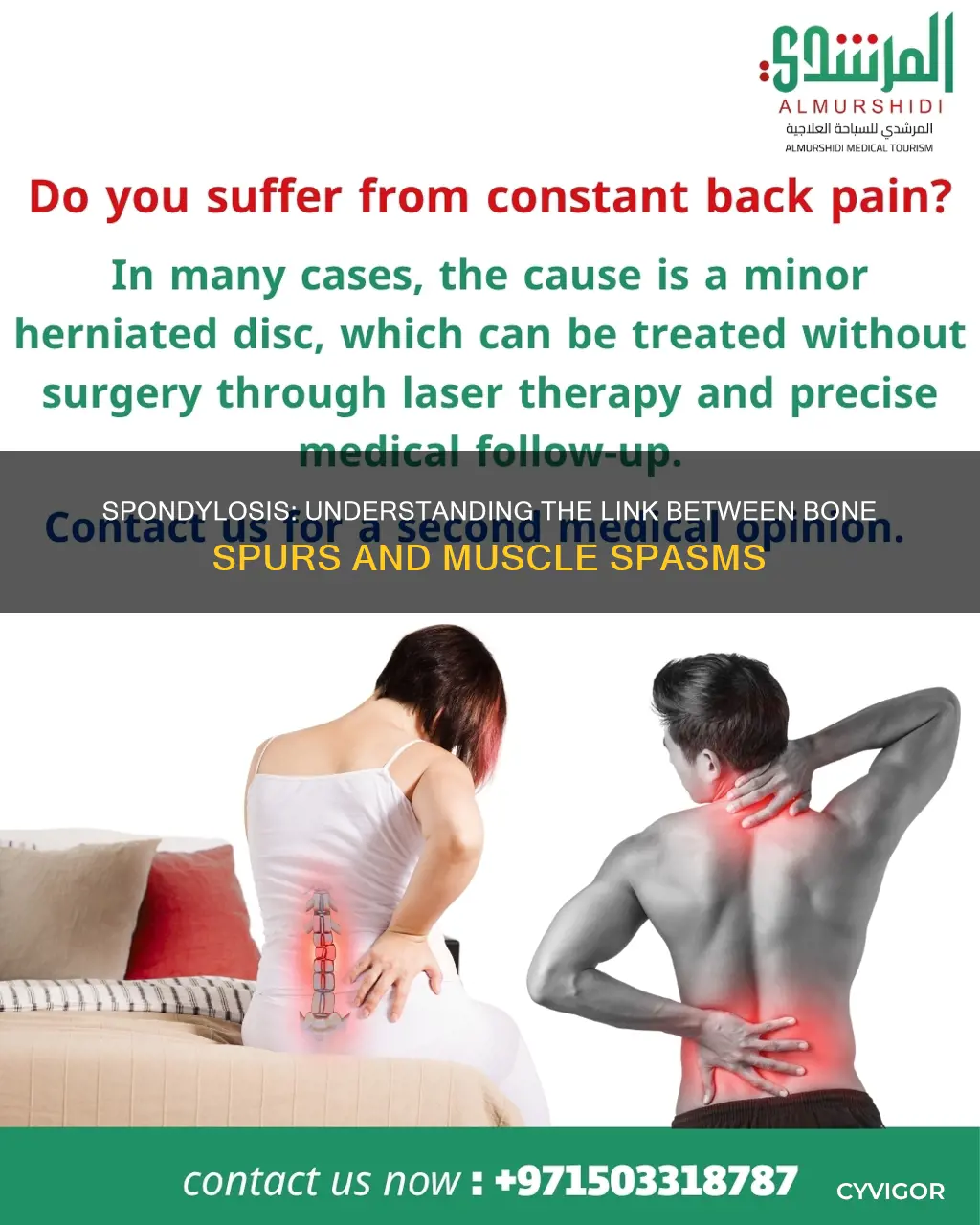 does spondylosis cause muscle spasms