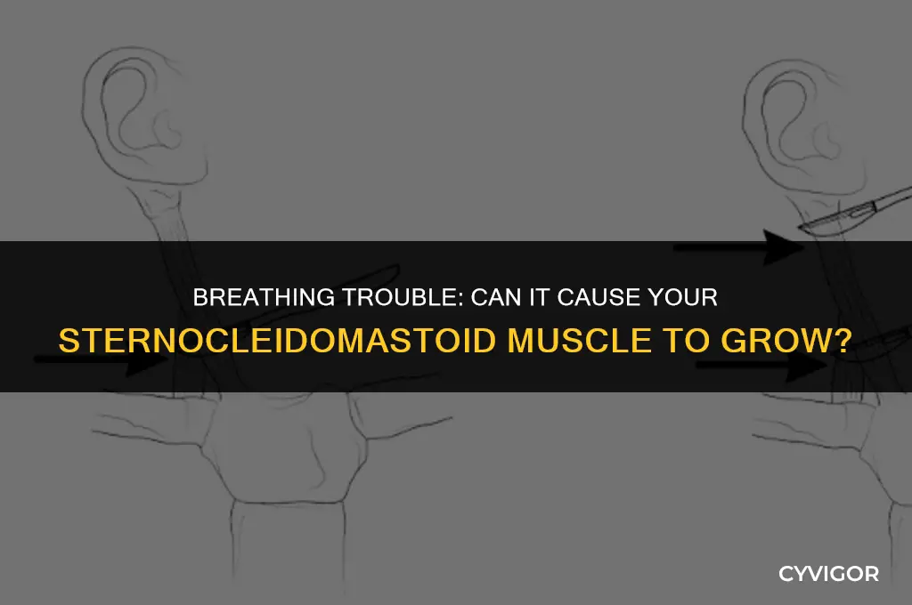 does sternocleidomastoid muscle get bigger with breathing trouble