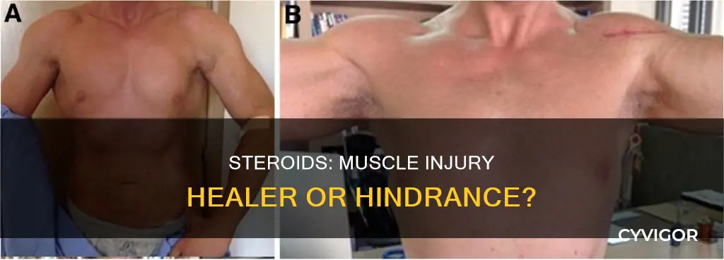 does steroids heal muscle injuries