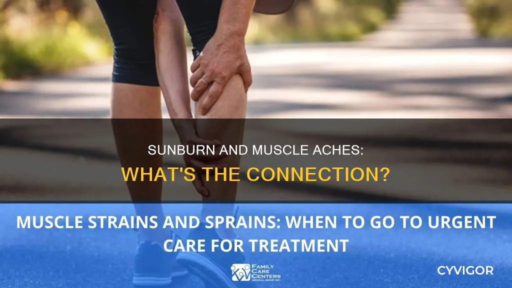 does sunburn cause muscle ache