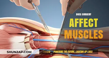 Exploring the Impact of Surgery on Muscle Health and Recovery