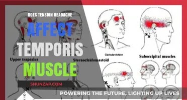 Exploring the Link: Tension Headaches and Temporalis Muscle Impact