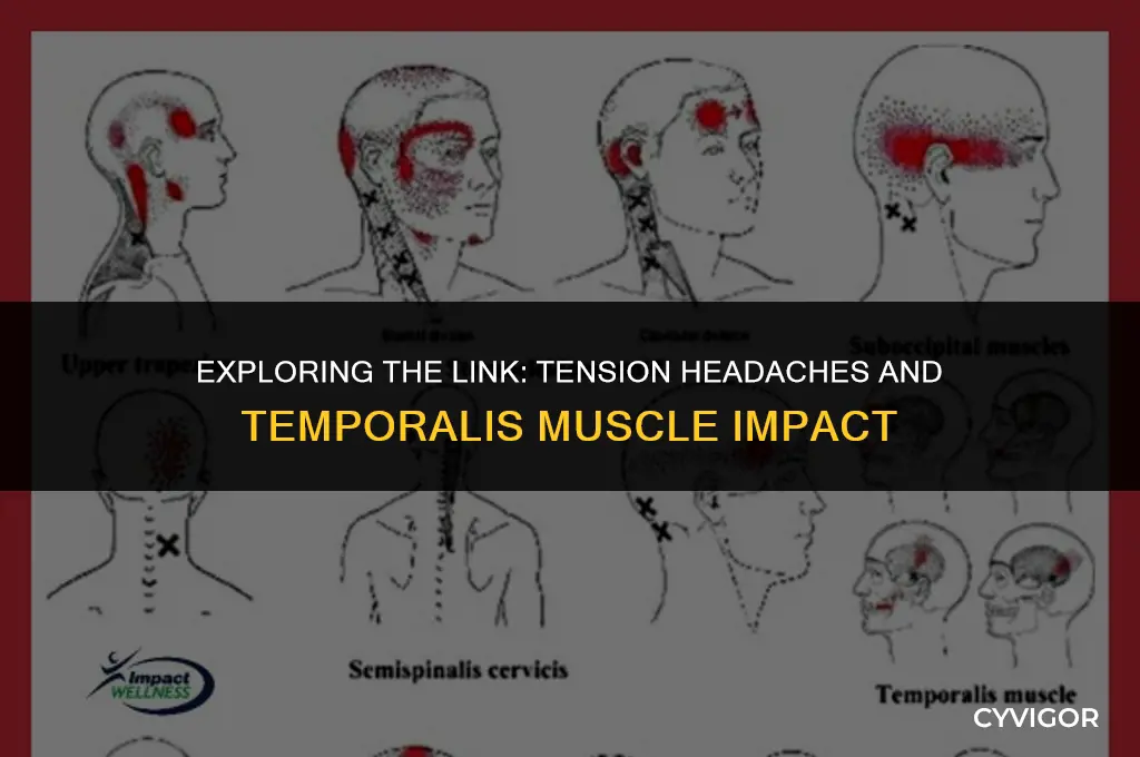 does tension headache affect temporis muscle