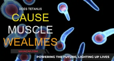 Tetanus: Understanding the Link Between Infection and Muscle Weakness
