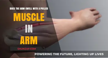 Pulled Muscle in Arm: Swelling Causes and Recovery Tips