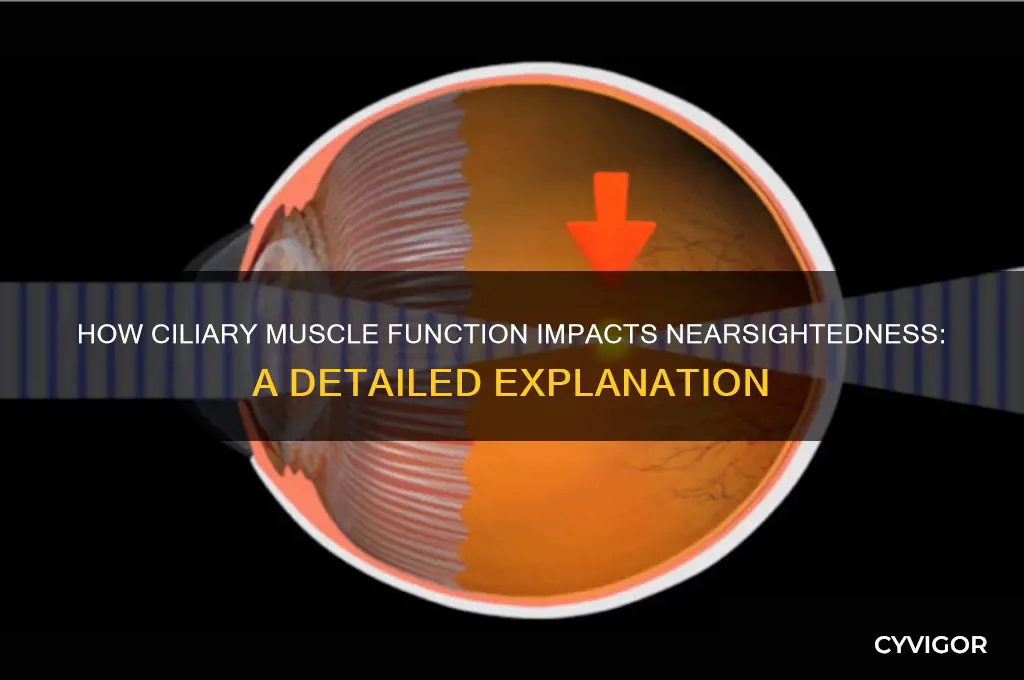 does the ciliary muscle pull in for nearsightedness