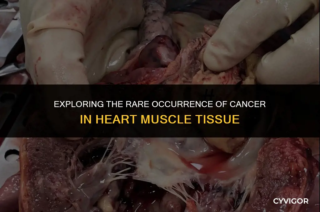 does the heart muscle ever get cancer