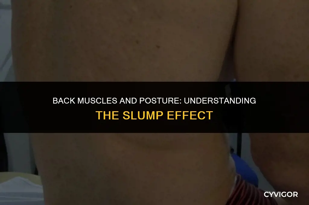 does the muscles in your back slump over