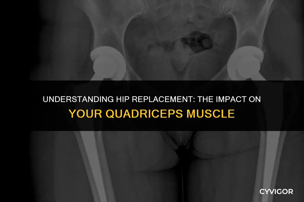 does the quad muscle get cut for hip replacement