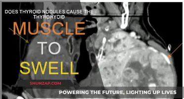 Thyroid Nodules: Can They Make the Thyrohyoid Muscle Swell?