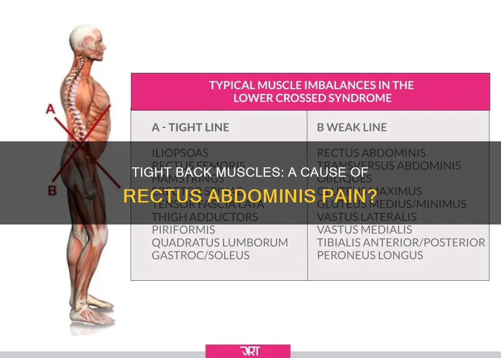 does tight back muscles cause rectus abdominis