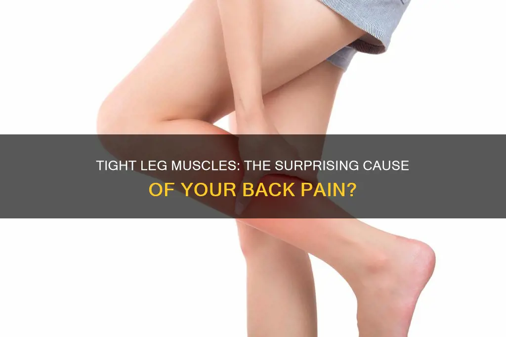 does tight leg muscles cause back pain