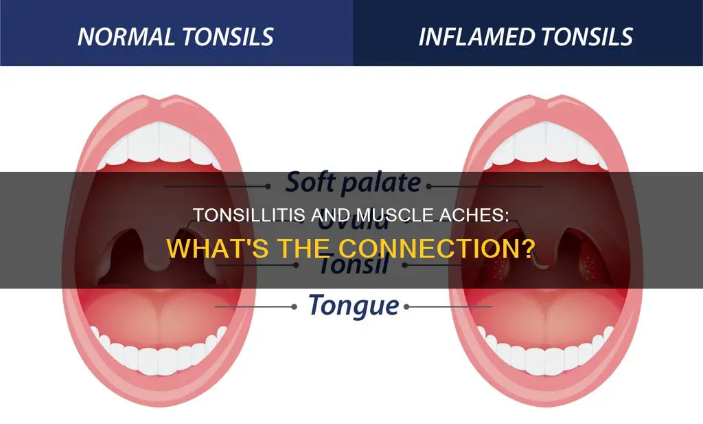 does tonsillitis cause muscle aches
