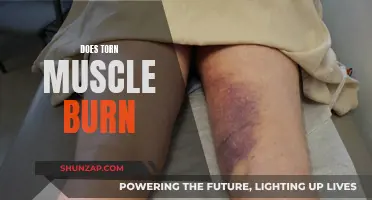 Torn Muscle and Burning Sensations: What's the Link?