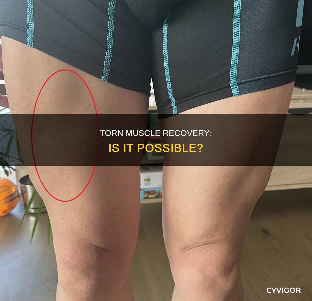 does torn muscle heal