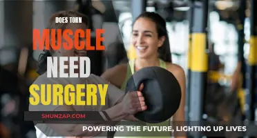 Torn Muscle Surgery: When Is It Necessary?
