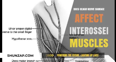 Exploring the Impact of Ulnar Nerve Damage on Interossei Muscles