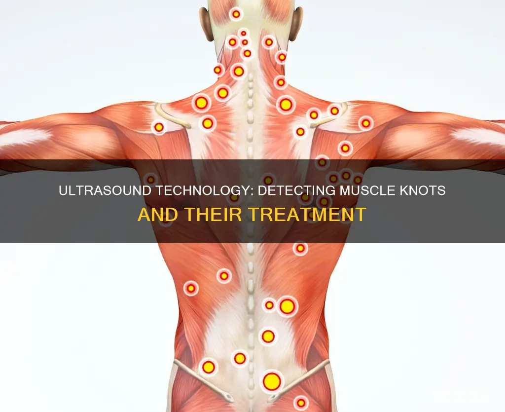 does ultrasound show muscle knots
