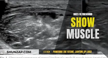 Ultrasound's Muscle Vision: What Can It See?