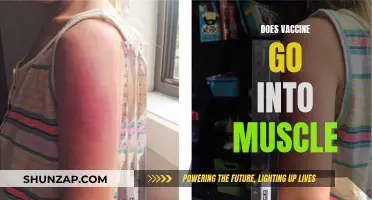 Vaccine Administration: Muscle Injections and Their Benefits