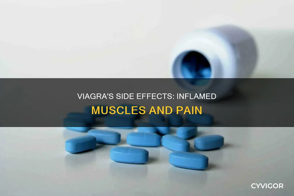 does viagra cause inflamed muscle pain