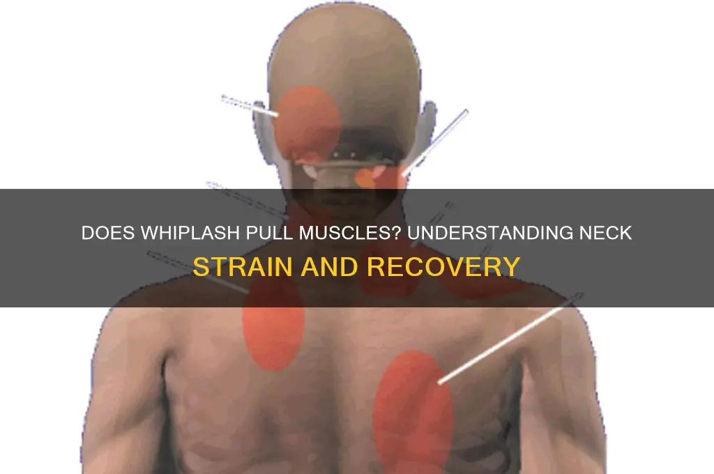 does whip lash pull muscles