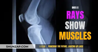 X-Ray Vision: Can We See Muscles?