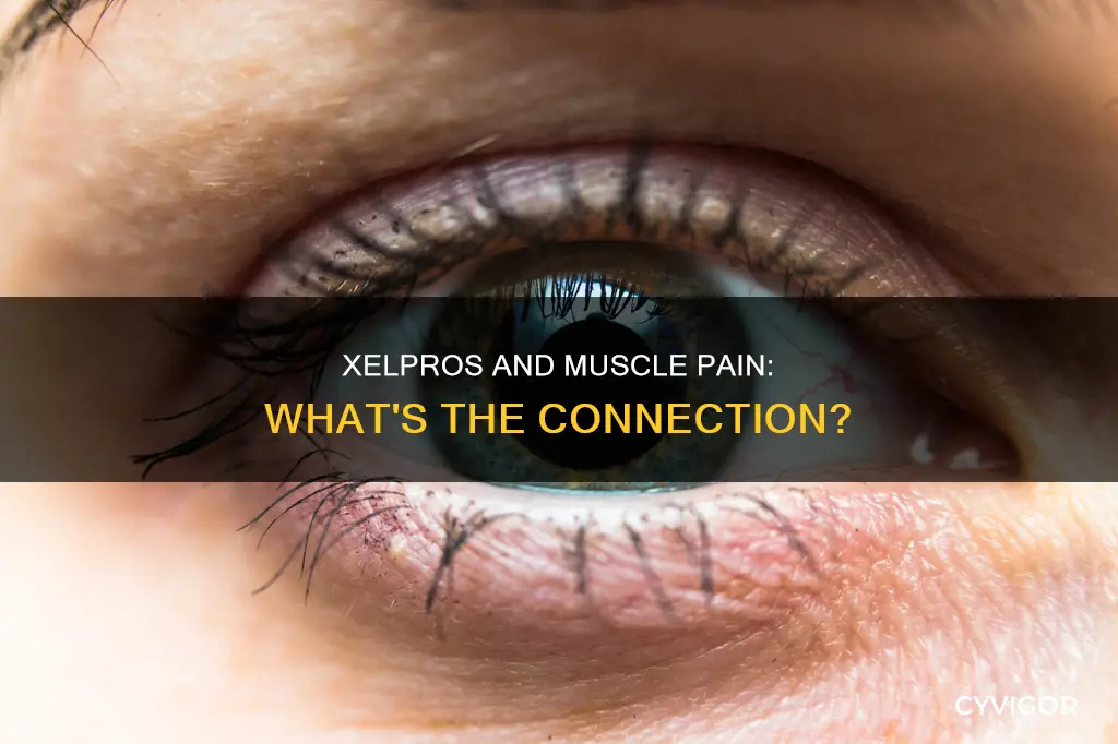 does xelpros cause muscle pain