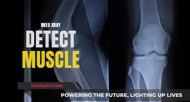 X-Ray Vision: Can It See Muscles?