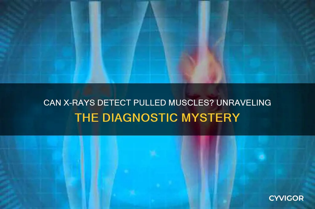 does xray show pulled muscle
