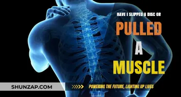 Disc Slip or Muscle Pull: Identifying Your Back Pain Cause