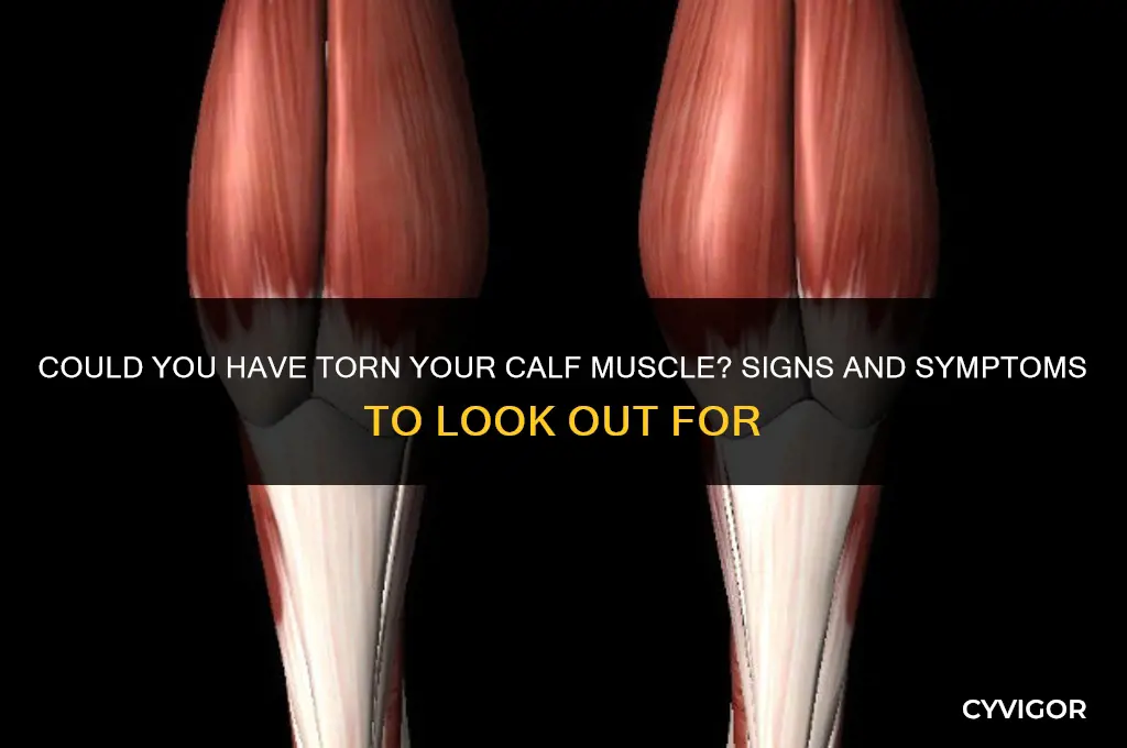 have i torn my calf muscle