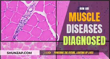 Muscle Diseases: Diagnosis, Tests, and Identification