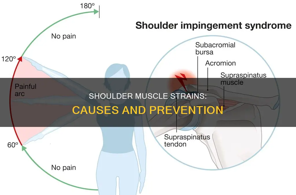 how are muscle strains caused in shoulder