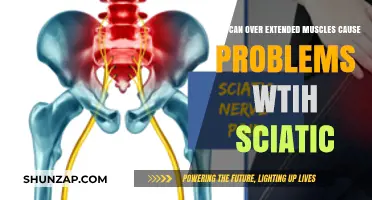 Over-Extended Muscles: Aggravating Your Sciatic Nerve
