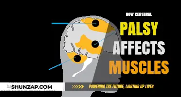 Understanding Cerebral Palsy: Impact on Muscle Function and Daily Life